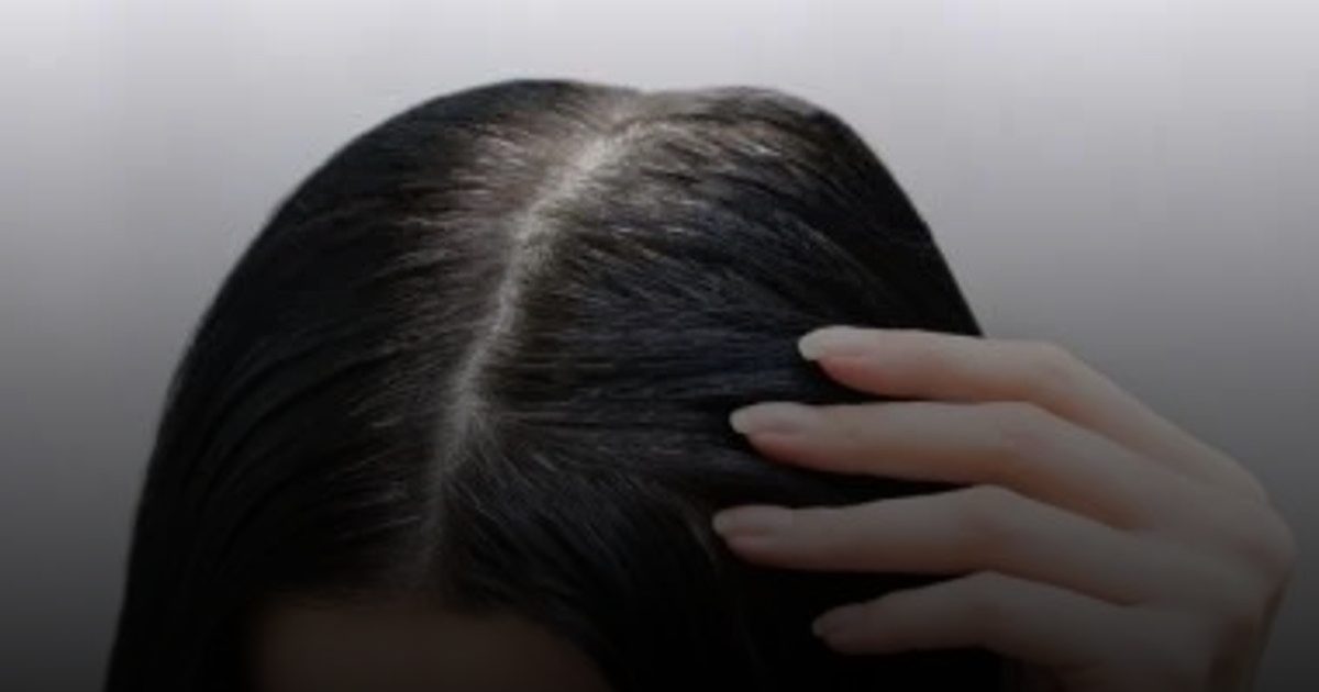 فيتامينات ومعادن ضرورية تدعم نمو الشعر وصحته