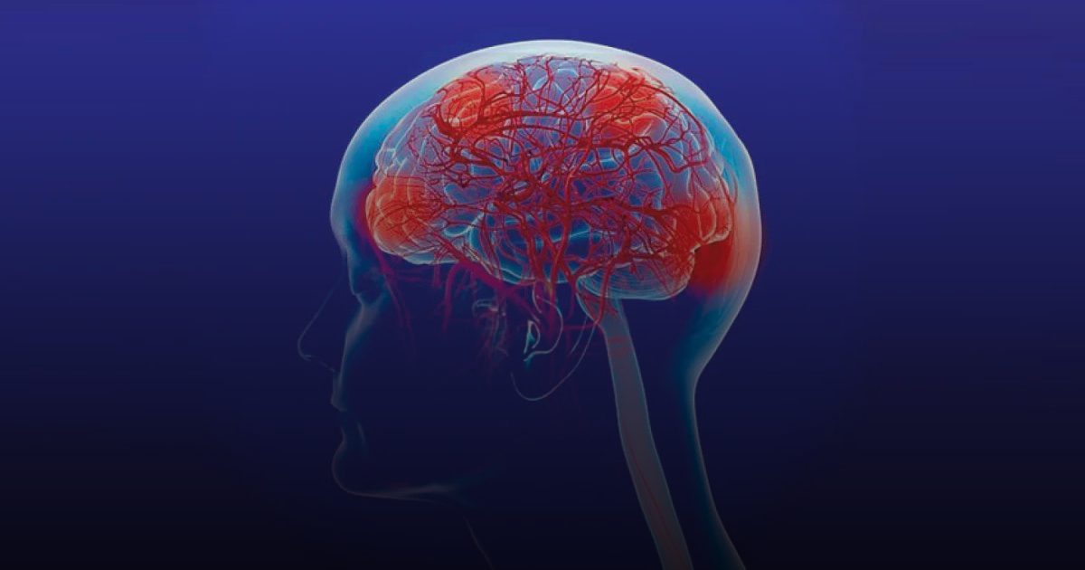 أدوية شائعة تثير الشكوك حول علاقتها بخطر الإصابة بالخرف