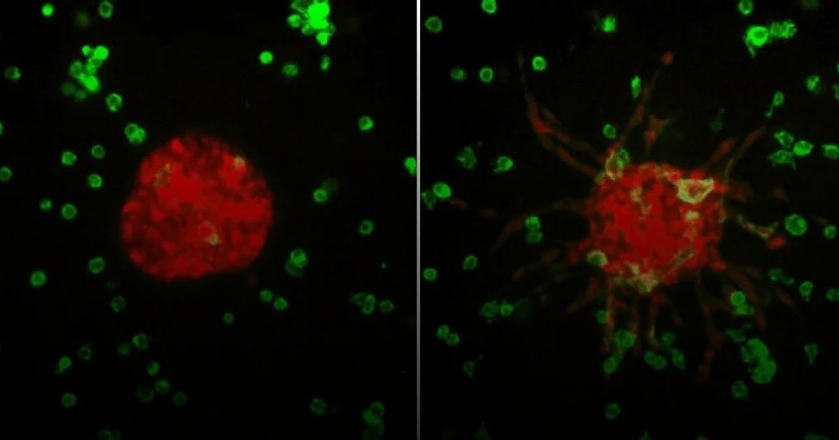 هجرة الخلايا السرطانية داخل الجسم تفسر لغز عودة المرض بعد الشفاء