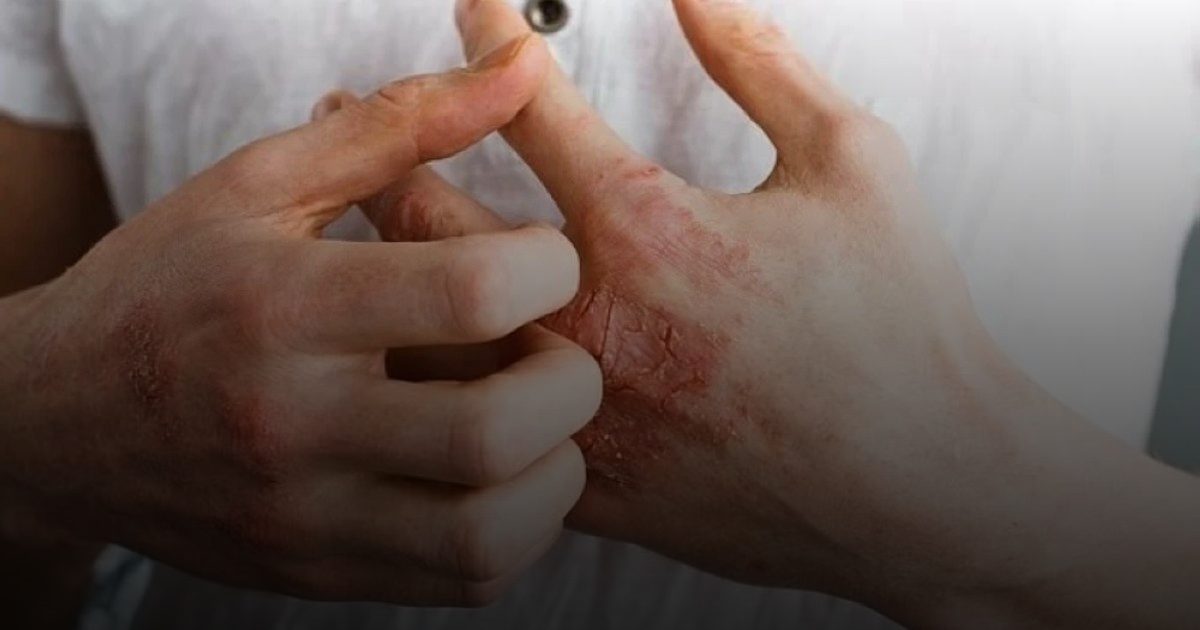 الطقس البارد يرفع خطر النوبات القلبية 10% والسلطات البريطانية تحذّر