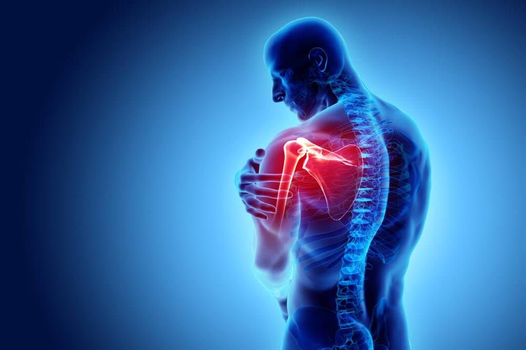 أسباب آلام الكتف.. منها الشد العضلي والترسبات الكلسية وتآكل المفاصل
