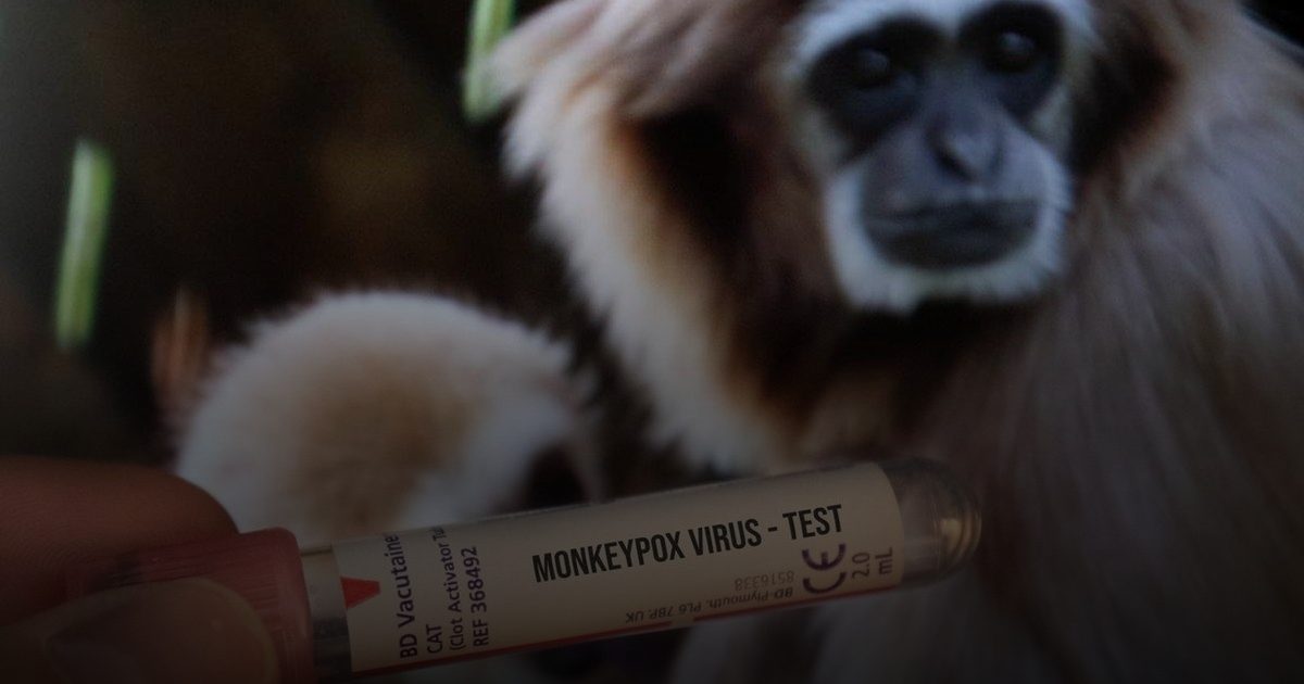 الصحة العالميةترصد فيروس متحور يضم سلالتين من جدري القرود