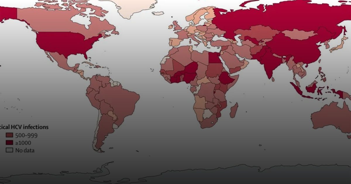 74 ألف طفل يولدون سنوياً بفيروس "سي" عالمياً..