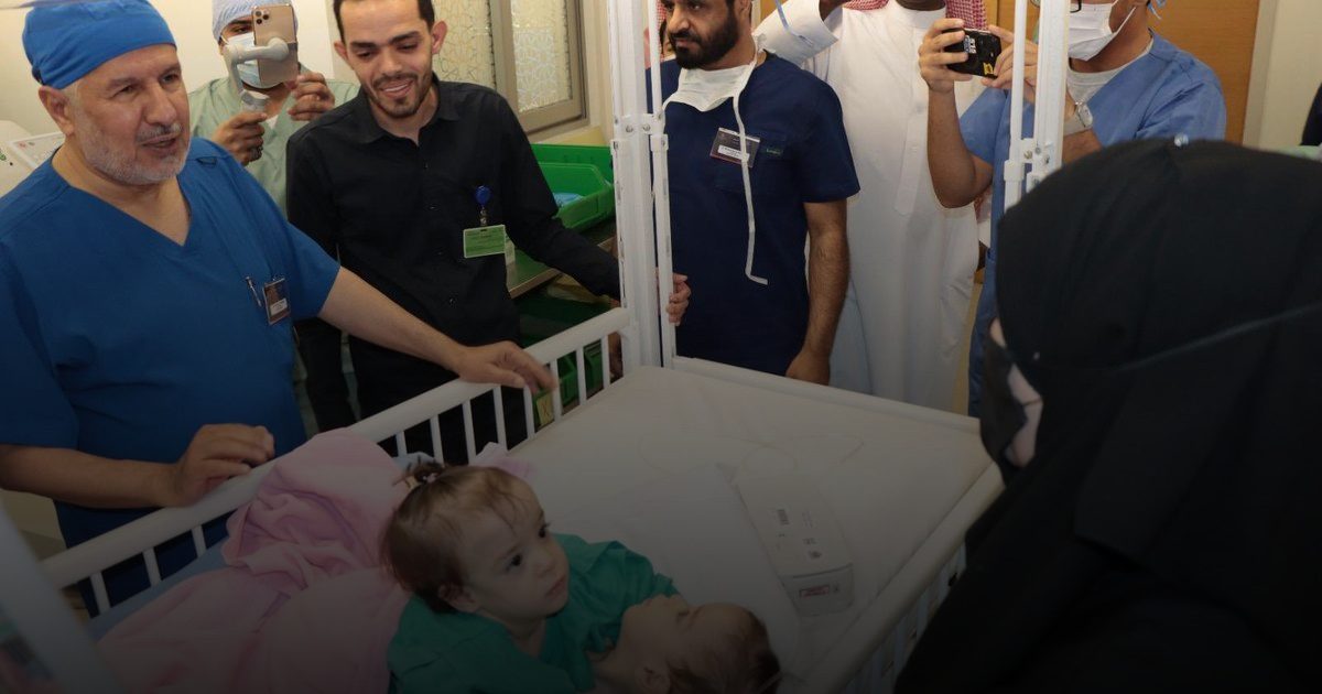 بدء عملية فصل التوأم السيامي السوري “سيلين وإيلين” في الرياض