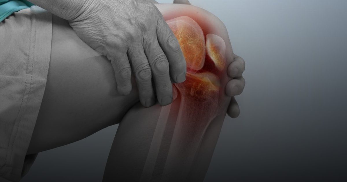 تجنب الإعاقة.. العالم يحتفل بيوم التهاب المفاصل لتأكيد أولوية العلاج المبكر