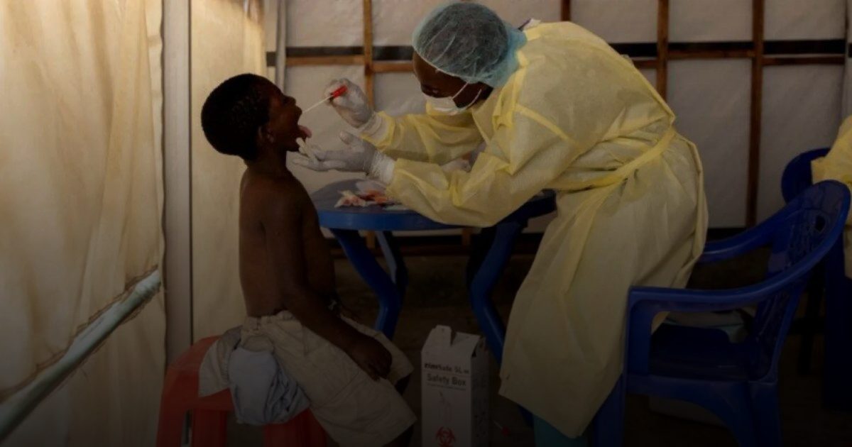 زيادة حادة في أوروبا لسلالة متحورة من جدري القردة تنتقل محليًا