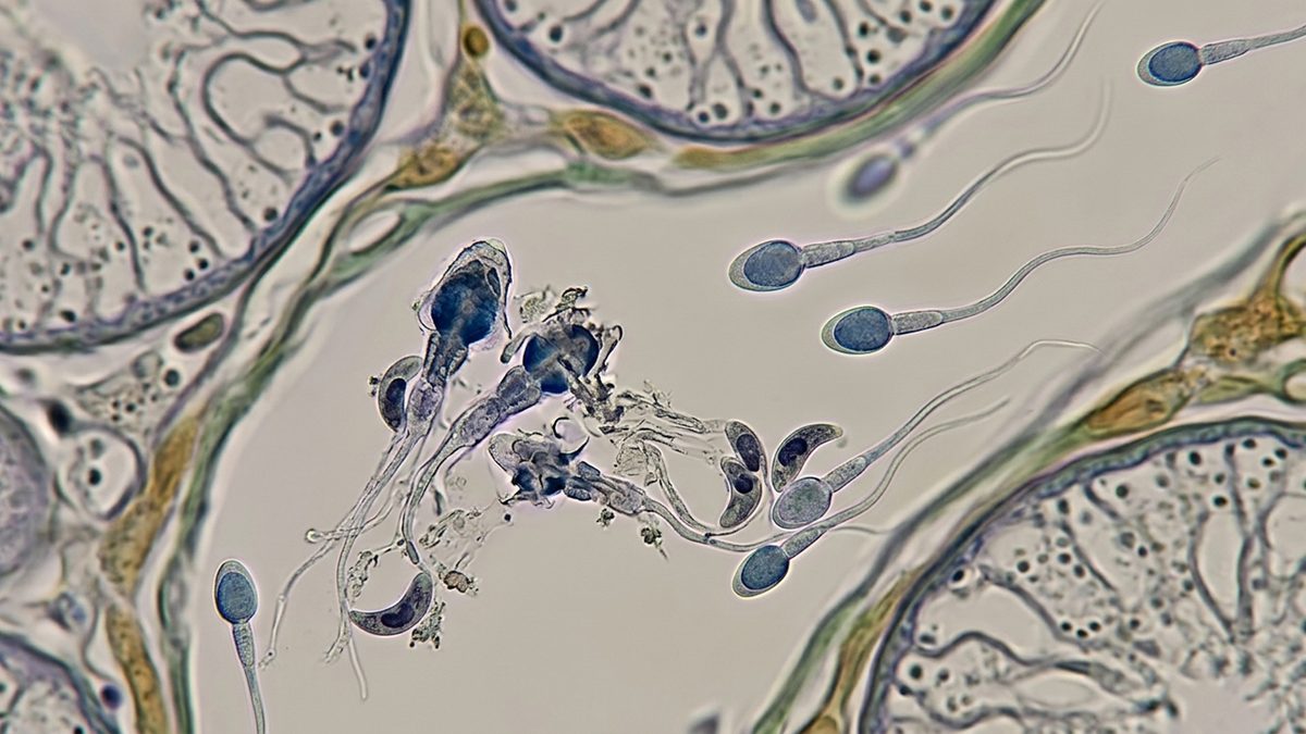 طفيلي التوكسوبلازما يمارس إبادة صامتة للخصوبة العالمية