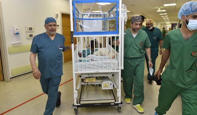 نجاح سعودي مبهر في فصل التوأم التنزاني "نانسي ونايس"