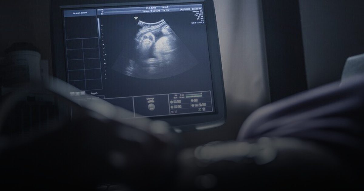 اكتشاف علاقة مباشرة بين عمر الأم وفشل تطور الأجنة بالتلقيح الاصطناعي