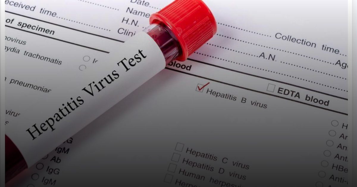 التهاب الكبد الفيروسي:  إنسان يموت كل 30 ثانية