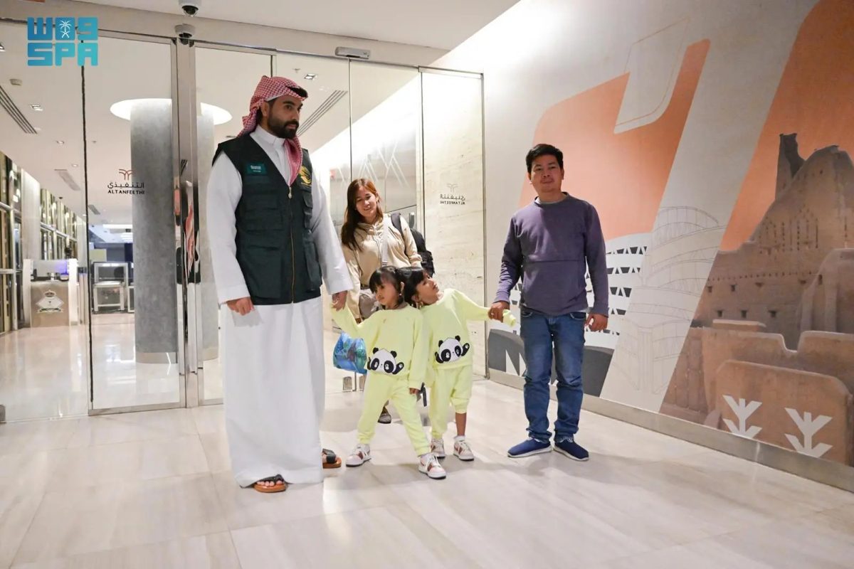 عملية لفصل أصعب توأم ملتصق بالعالم تنطلق.. الخميس