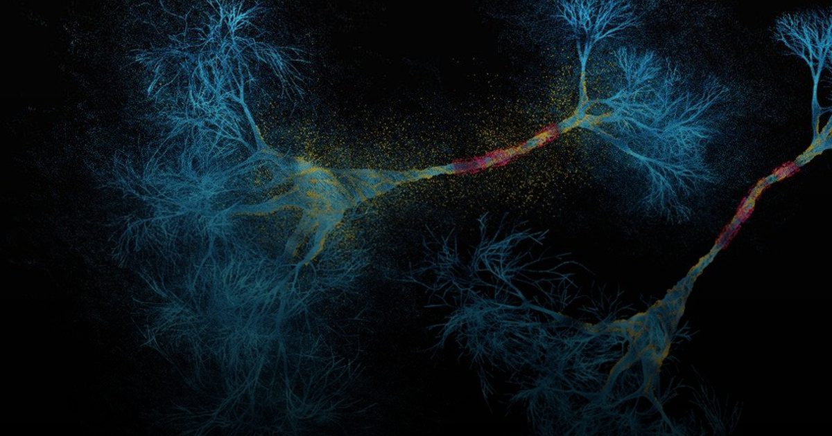 الذكاء الاصطناعي يكتشف وجهين جديدين للتصلب المتعدد