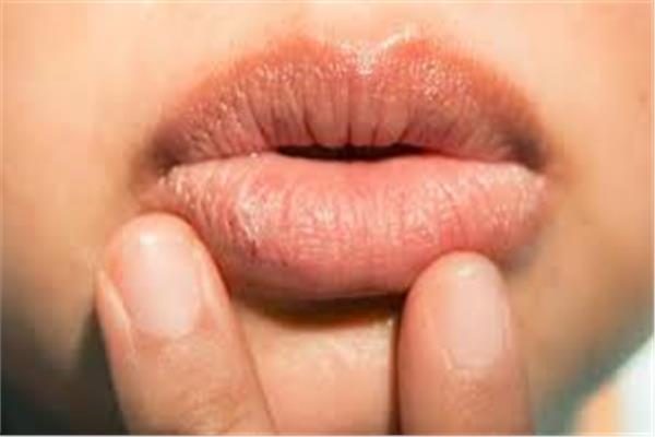 هل تغيّر لون شفاهك؟ اكتشف الأسباب والعلاج الفعّال
