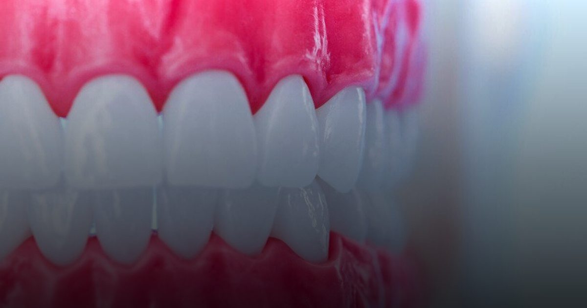 جمعية القلب الأمريكية تحذر: التهاب اللثة يهدد سلامة الشرايين