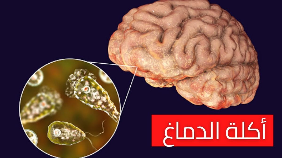 "الأميبا آكلة الدماغ" كائن مجهري وحيد الخلية قتل 160 أمريكياً