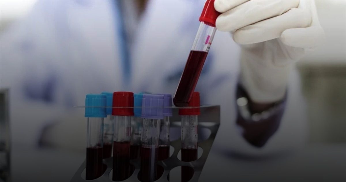 ثورة علمية..العلاج المناعي للسرطانات قادر على هزيمة سرطان الدم