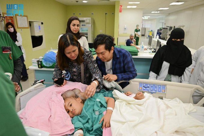 مقيم فلبيني يشكر المملكة: "فصل التوأم لمس قلوب الملايين"