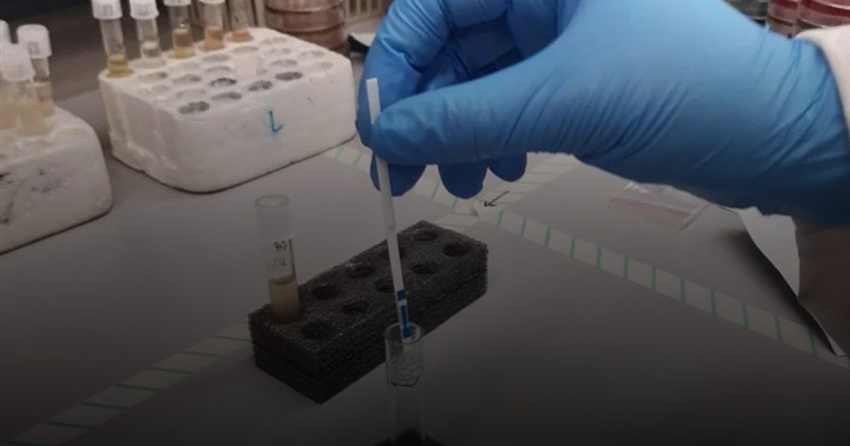 الصحة العالمية: ارتفاع ملحوظ في حالات الإصابة بالكوليرا في العالم عام 2024