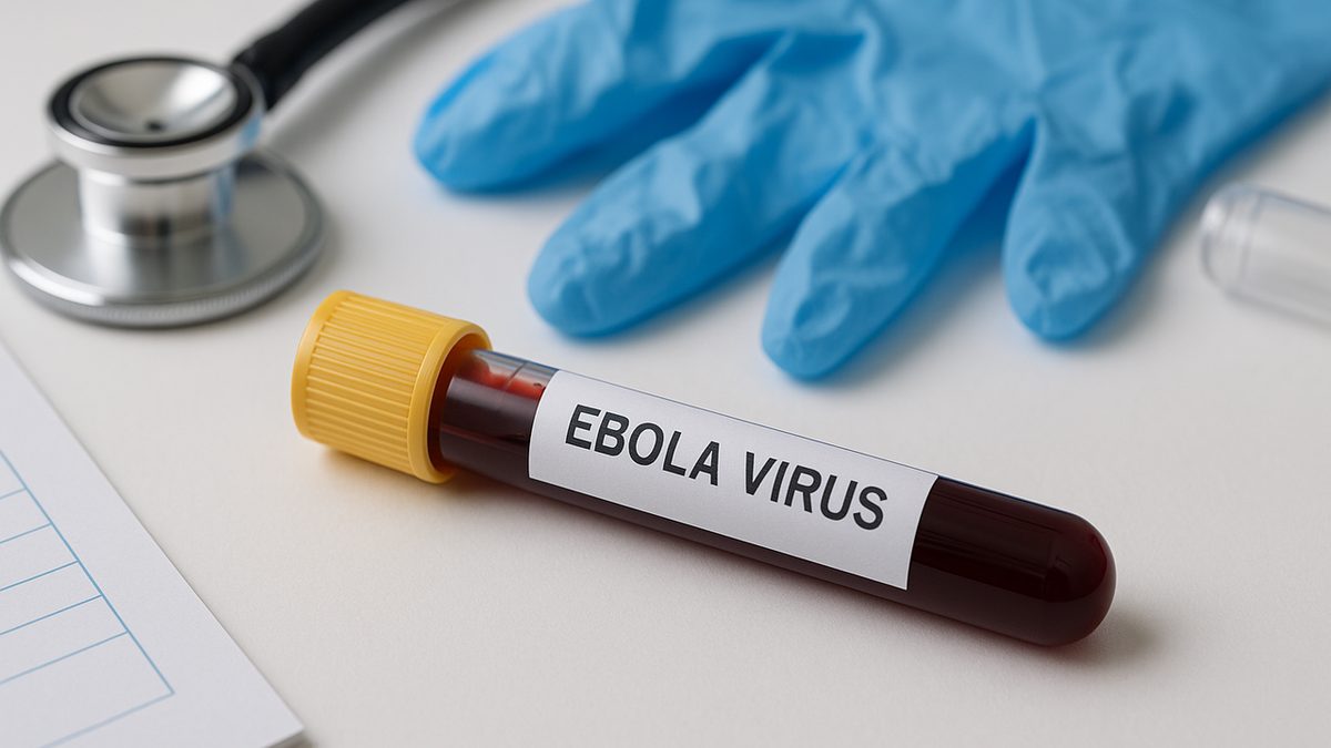 الإيبولا لا ينقل العدوى قبل الأعراض: تحديات التشخيص المبكر