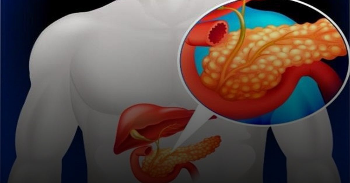 الكحول والمواد الكيميائية يسببان تليف الكبد