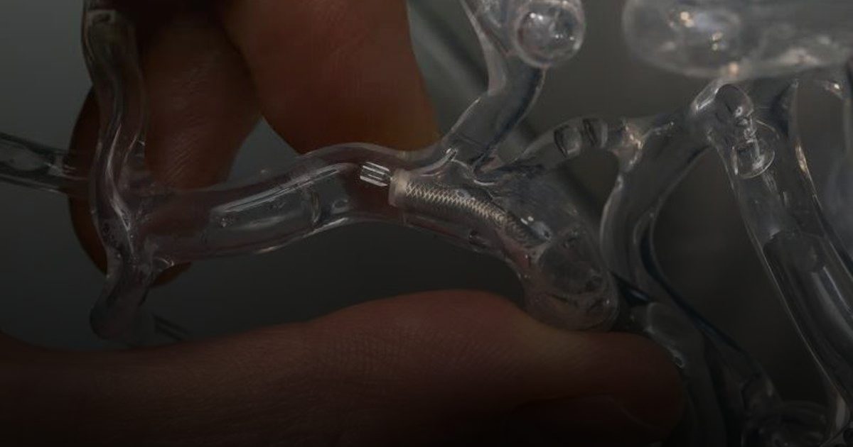 ابتكار علاج للجلطات الدموية يغير قواعد اللعبة