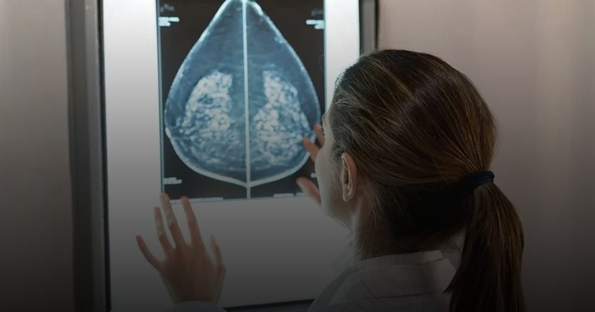 ترخيص منصة ذكاء اصطناعي للتنبؤ بسرطان الثدي في أمريكا