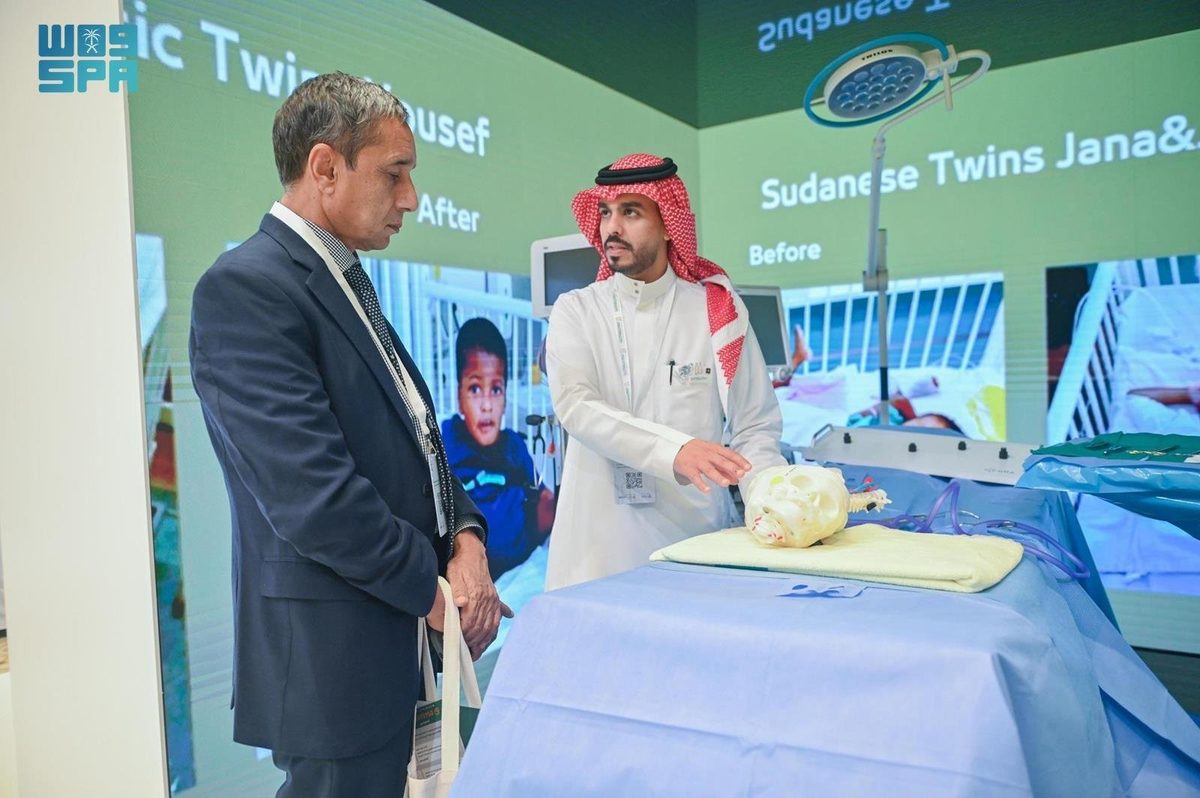 "غرف العمليات التفاعلية" تميز معرض مؤتمر التوائم الملتصقة