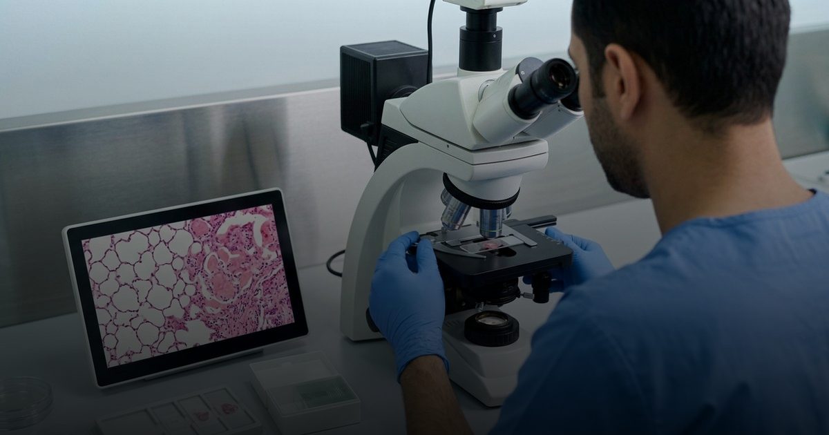 كيف يحوّل الالتهاب الرئوي الحويصلات الهوائية إلى أكياس للحياة؟