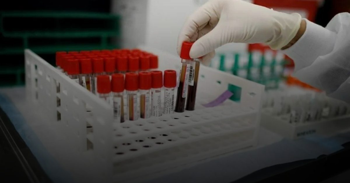 دعوة عالمية لتكثيف التوعية في اليوم العالمي لالتهاب الكبد الفيروسي