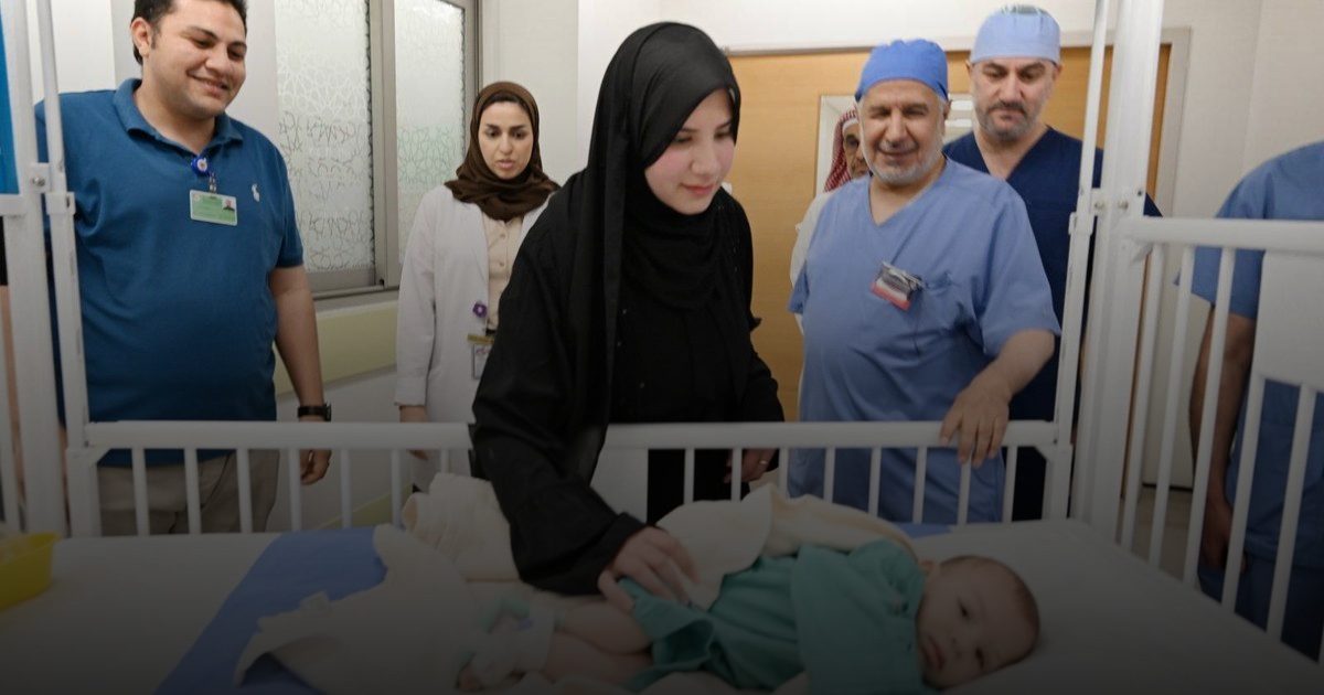 بعد نجاح فصل التوأم المصري.. الإنجاز رقم 63 في تاريخ البرنامج السعودي لفصل التوائم