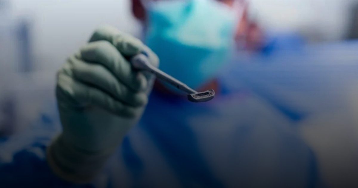 أول عملية جراحية في العالم للعمود الفقري بغرسة تيتانيوم ثلاثية الأبعاد