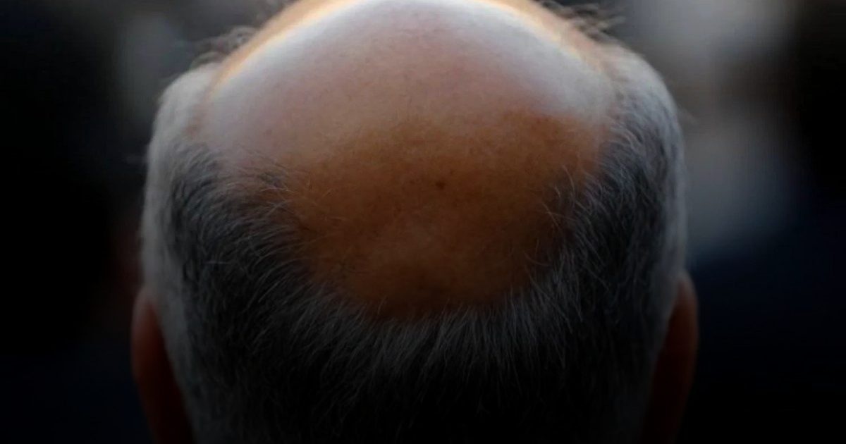 زيت بذور اليقطين يعالج تساقط الشعر..