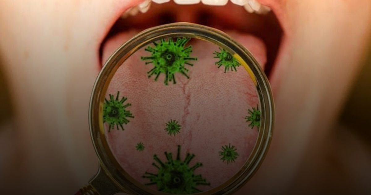 ميكروبات الفم قد تساهم في سرطان البنكرياس