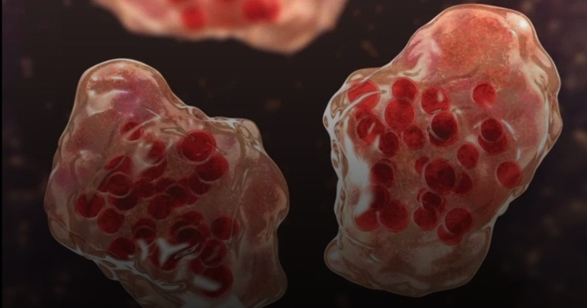 وفاة طفل بعد تعافيه من الحصبة تدق ناقوس الخطر