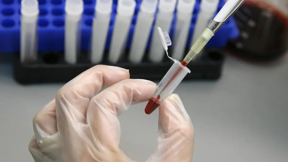 الأمم المتحدة: تجميد ترمب المساعدات الخارجية قد يتسبب في وفاة ملايين إضافيين بسبب الإيدز