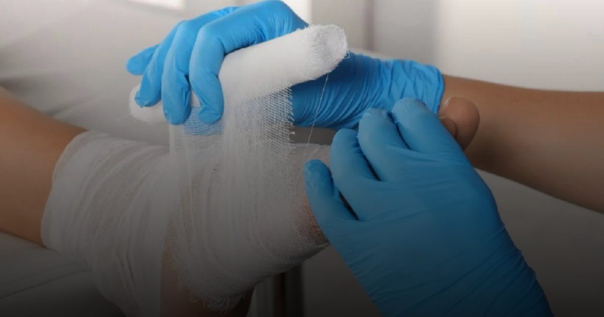 ضمادة صينية ذكية تعجل شفاء جروح السكري المزمنة