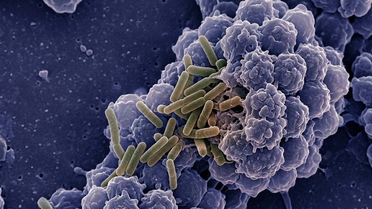 تقنية بكتيرية ذكية تهدد حصون الأورام السرطانية الصلبة