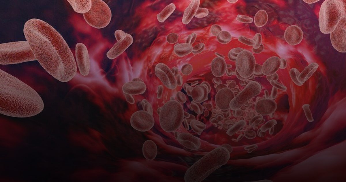 دراسة ترصد تجمعات دم غير طبيعية في دماء مصابي كوفيد الطويل