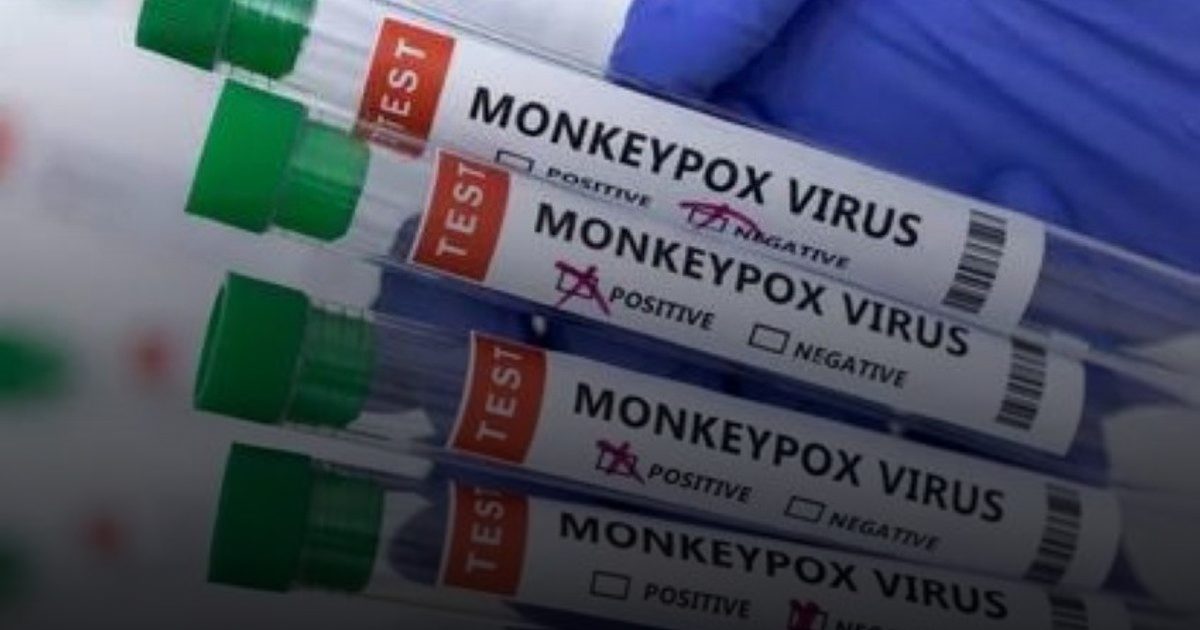 تسجيل أول إصابة بجدري القرود في برلين