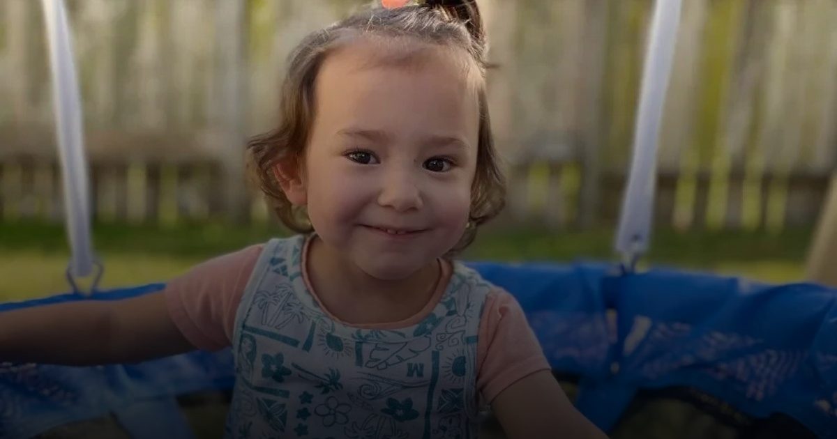 "جلد السمك" ينقذ طفلة حديثة الولادة من تسمم الدم