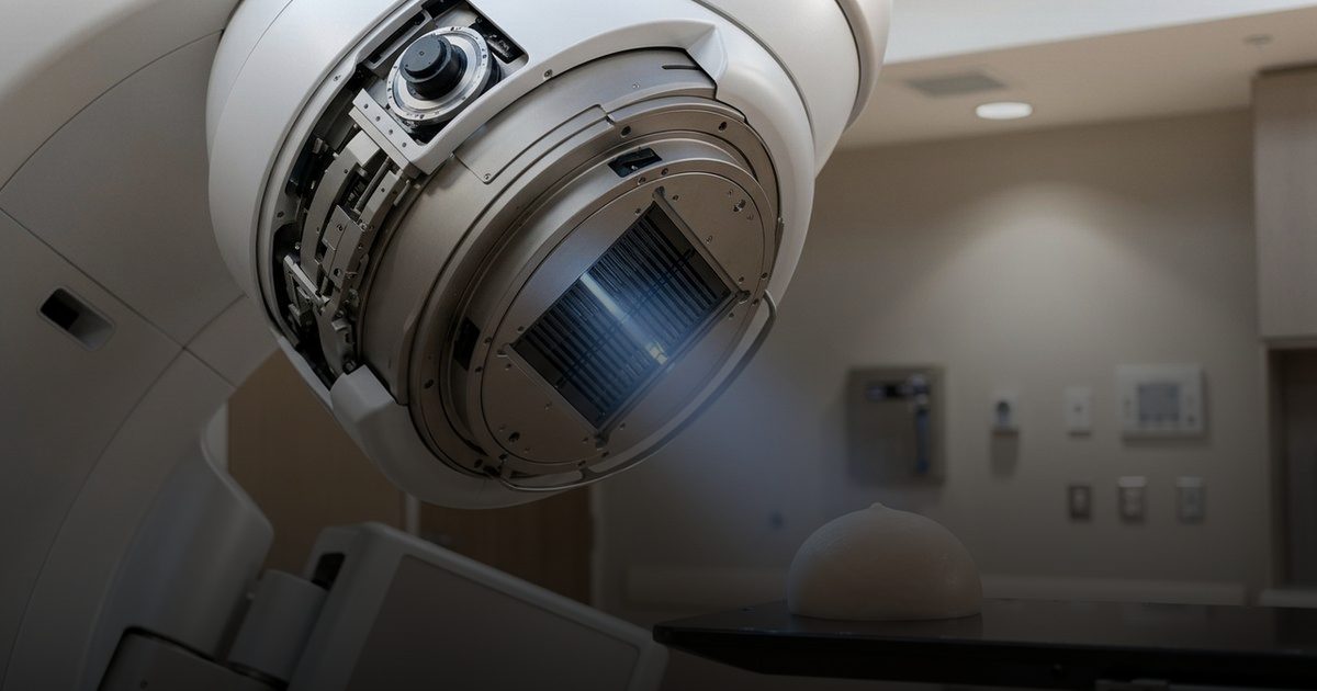 علاج إشعاعي مبتكر يغير قواعد مكافحة سرطان الثدي