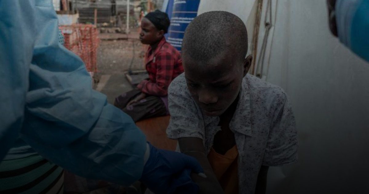 ارتفاع الإصابات بجدري القردة في غينيا إلى أكثر من 300 حالة