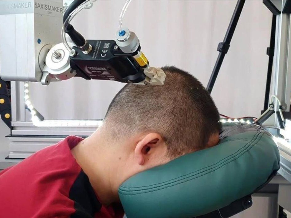 علماء يبتكرون حبرًا سائلًا لقياس نشاط الدماغ بدقة وراحة