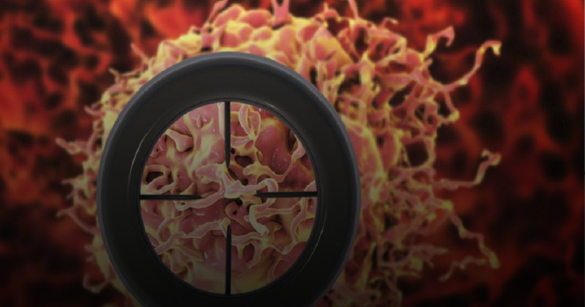 حقائق حول العلاقة الحميمة وسرطان البروستاتا