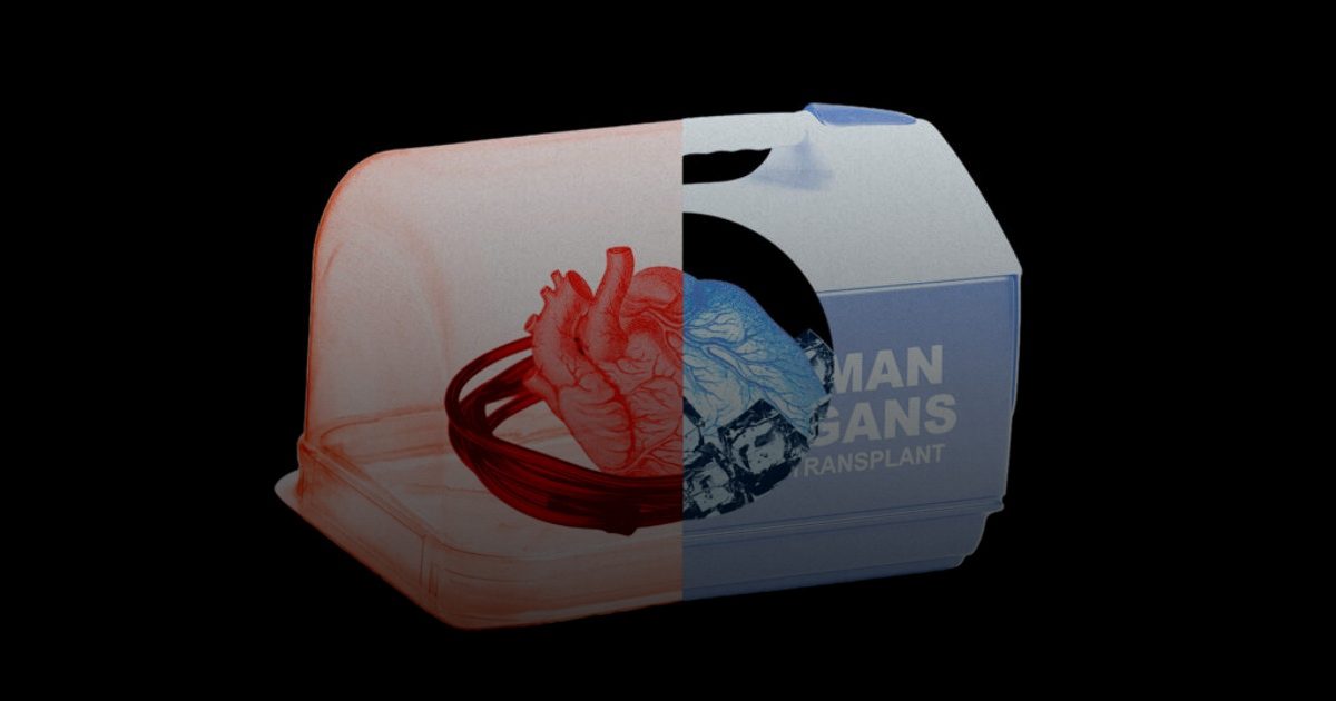 ثورة في زراعة الأعضاء بفضل تقنيات التروية الحيوية الحديثة