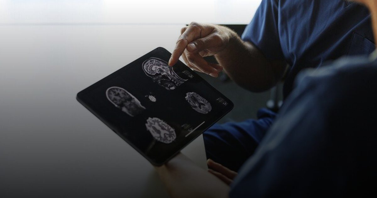 "خزان الذاكرة".. كيف يحمي حجم الرأس الدماغ من الخرف؟