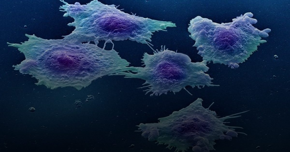 تقنية جديدة تُدمر 90% من خلايا السرطان بالضوء في 30 دقيقة