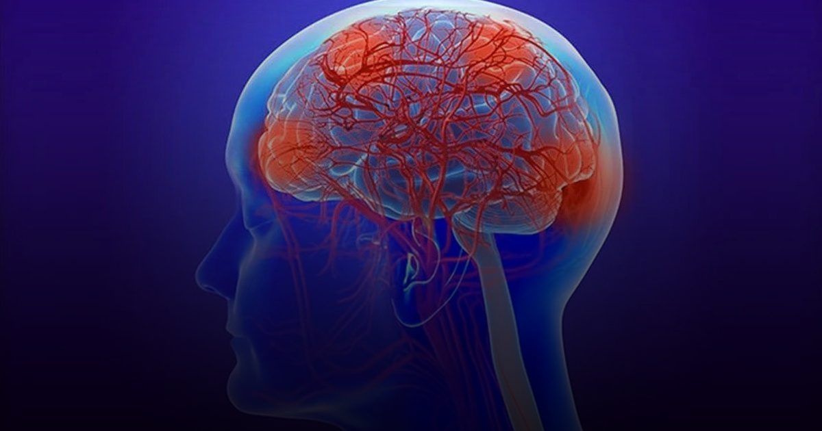 3 عوامل في منتصف العمر تساهم في تطوّر الخرف