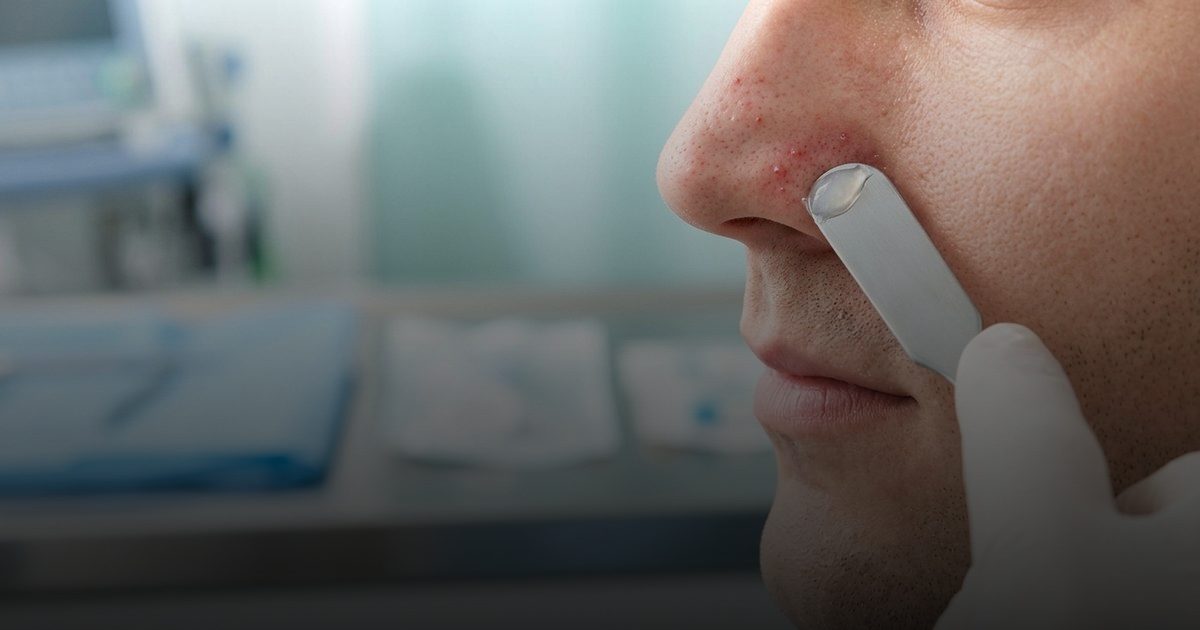 بثور الأنف.. حلول فعّالة لعلاجها ومنع الالتهابات الخطيرة