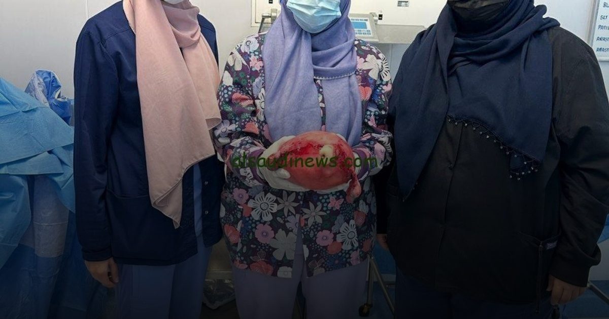 استئصال ورم 3 كجم ينهي معاناة أربعينية في مستشفى حراء بمكة
